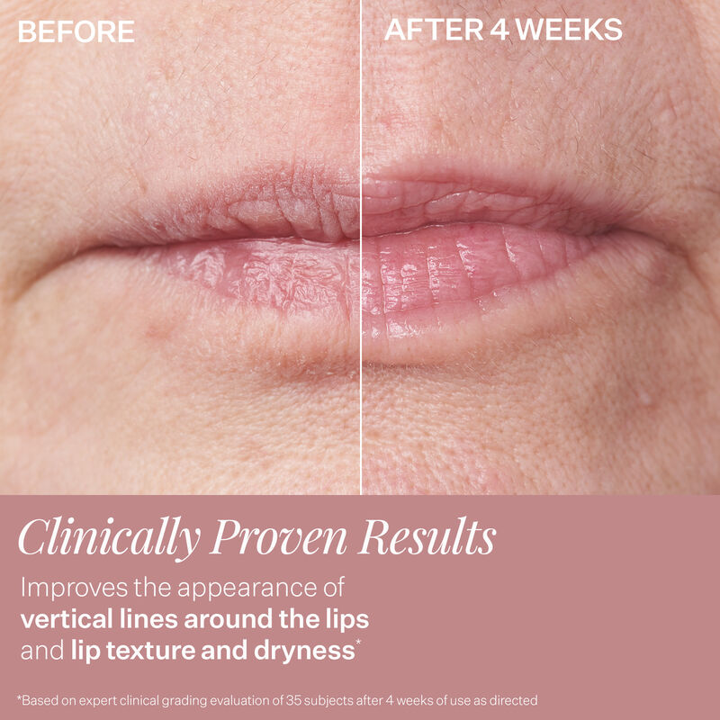 Double Fix™ for Lips Plumping & Vertical Line Treatment, , hi-res